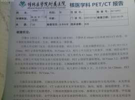 请教一下 肺腺癌IIIC期，基因检测无靶点，有PD-L1表达 后续情况应该怎么治