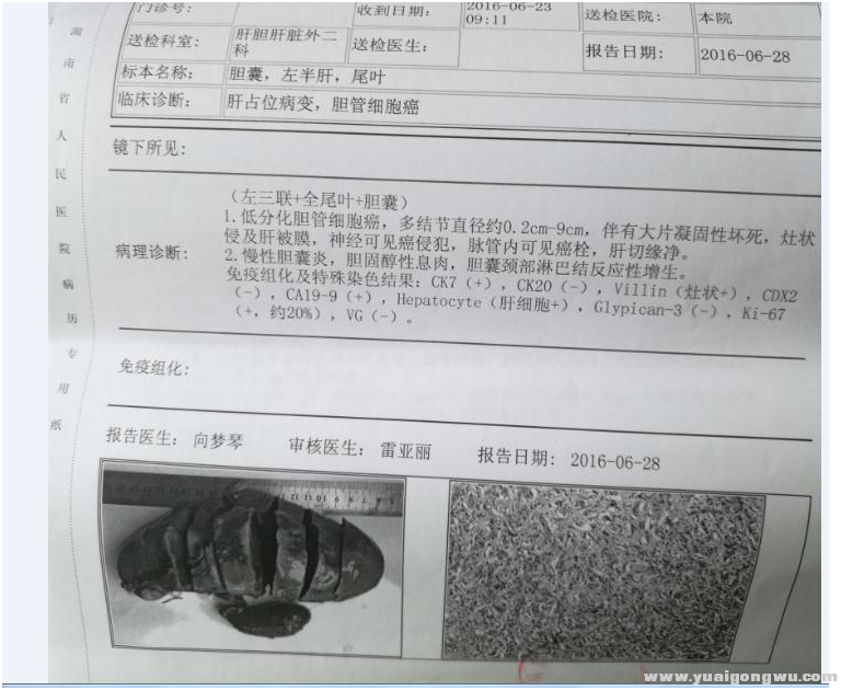 图片一--病理分析