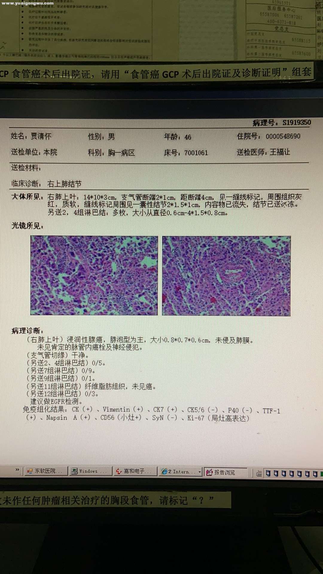 2019年11月病理报告