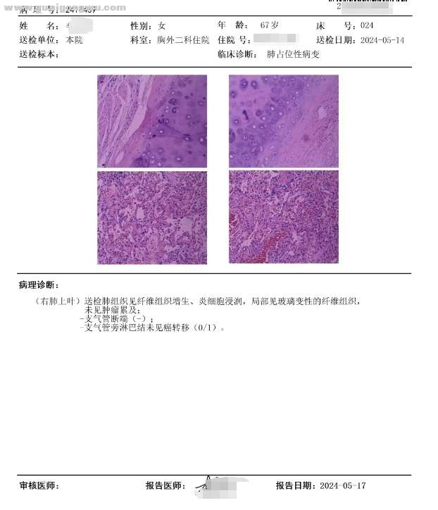 病理报告01